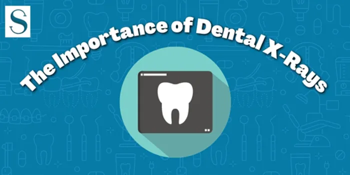 dental x-rays infographic